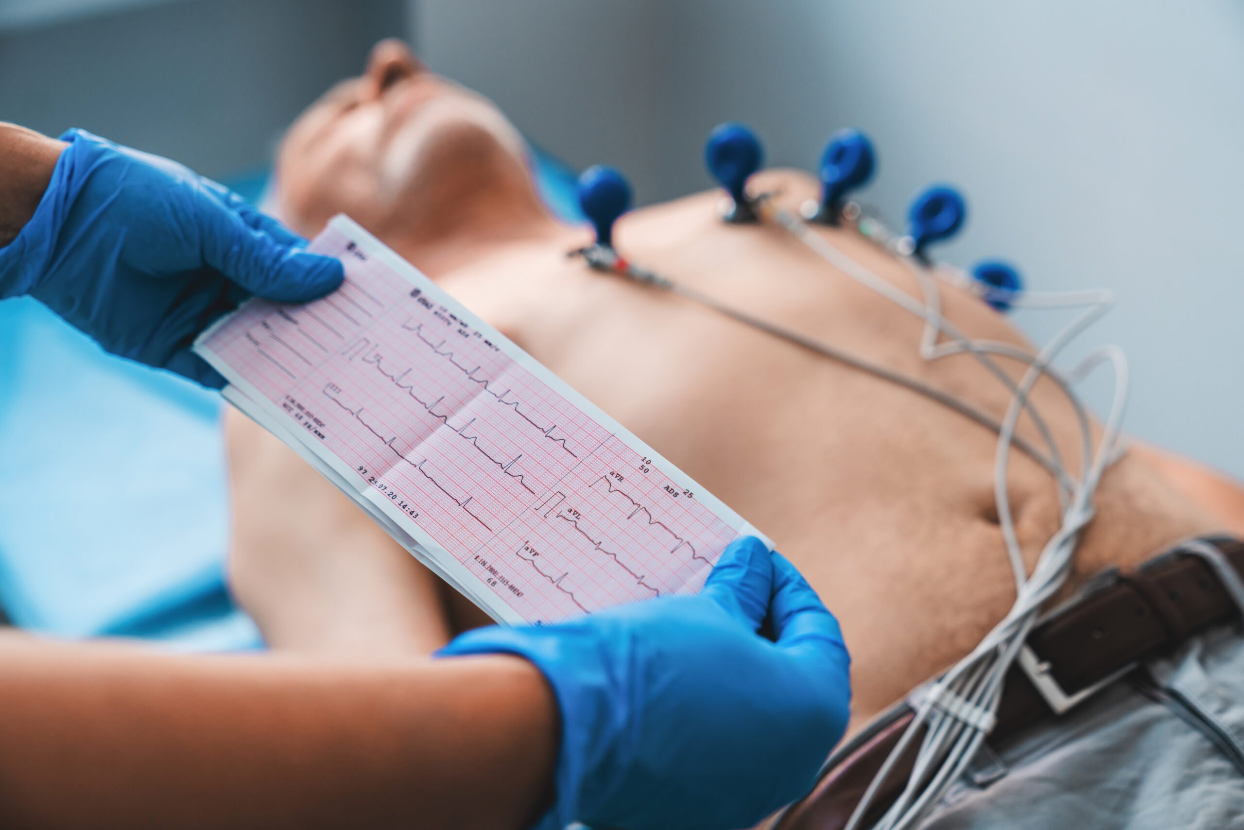 Electrocardiograma EKG