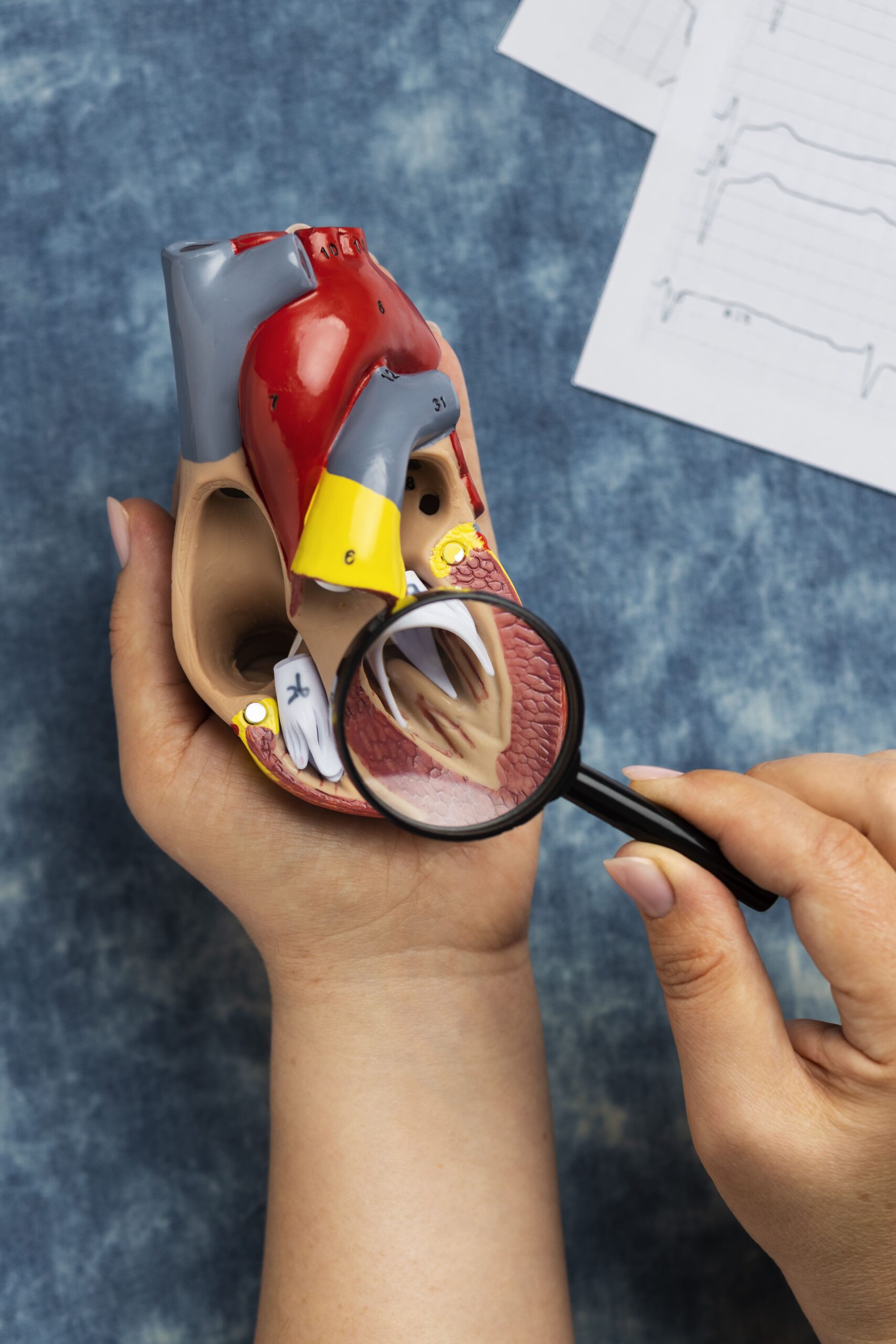 Arteriografías Periféricas